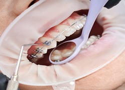 luxe-patna-dentist