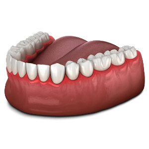 Gums Treatment